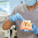 The Lowest Priced Countries to Experience Dental Implants Abroad